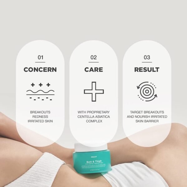 51jMji4bIvL._SL1000_.jpg Butt Acne Cream | Buttocks Acne Lotion for Body Blemishes | Body Acne Cream Formulated with Natural Formula | Butt Acne Clearing Treatment Lotion | Butt Acne Spot Cream Targeting Stubborn Blemishes