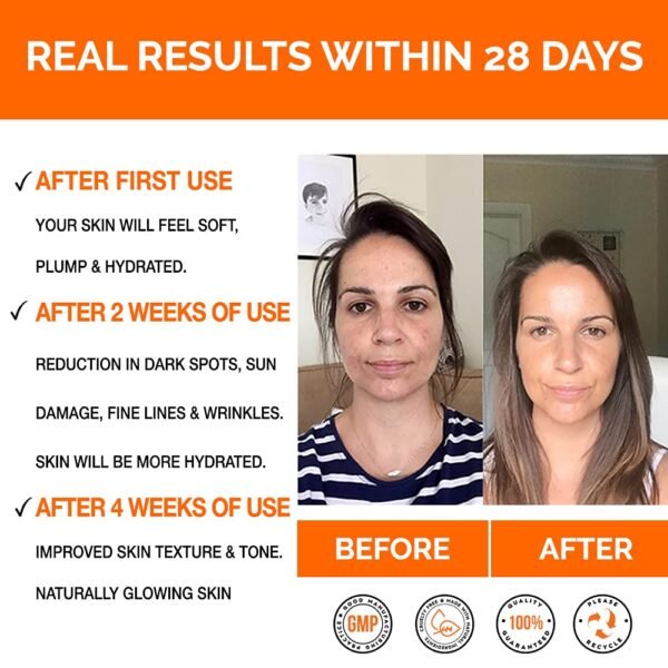 Vitamin C Serum - Anti Ageing, Hydrating & Brightening Serum for Face with Hyaluronic Acid - Uniquely Designed Day & Night Serum