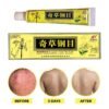 Official Seller - Chinese Herbal Cream - Natural Relief for Skin Issues - Pack of 5