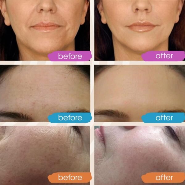 61DUvAeg8NL._SL1200_.jpg Retinol Serum for Face, Vitamin C with Hyaluronic Acid Face Serum for Women and Men, Glow Skin Care Set Total Package Targets Appearance of Uneven Skin Tone and Dryness 3x1oz