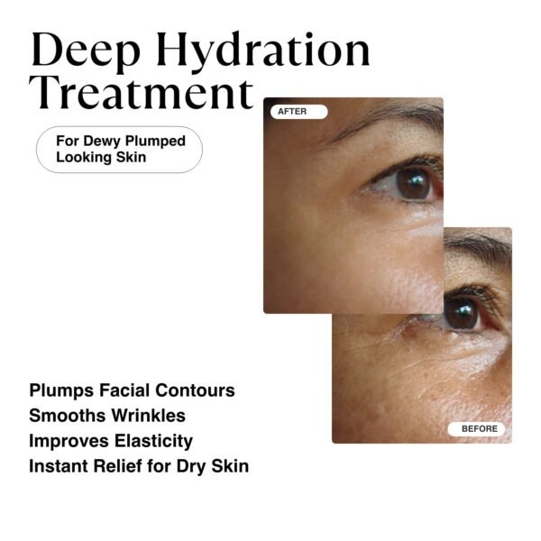 MATKAS Korean Firming Boost Hyaluronic Acid Serum 1 Fl. Oz. - Niacinamide and Hyaluronic Acid Serum for Face Korean Skin Care for Anti Aging, Hydrating Face Moisturizer for Dry Sensitive Skin