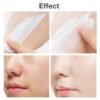 61SDDCmK7L._SL1000_.jpg Cystic, Hormonal, Severe Acne Cream for Teens & Adults with Hyaluronic Acid Aloe Vera Oil Cystic , Unisex Sensitive Skin Blind Pimple & Blemish (1 PACK)