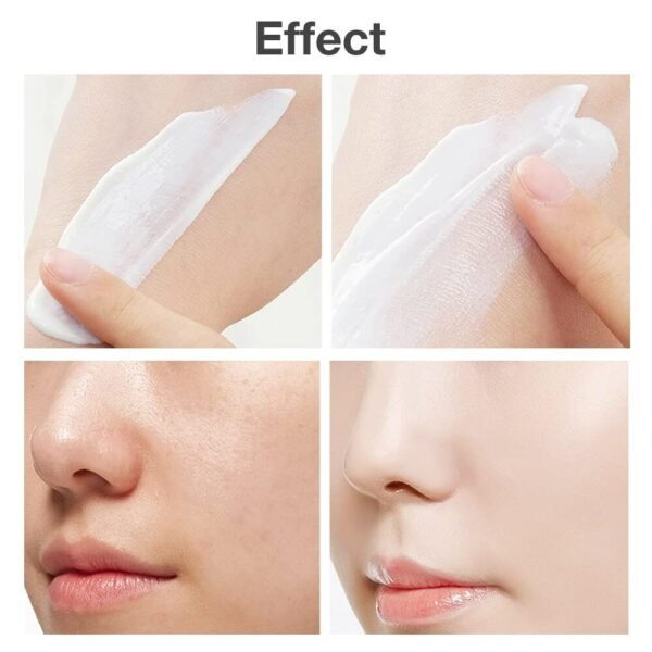 61SDDCmK7L._SL1000_.jpg Cystic, Hormonal, Severe Acne Cream for Teens & Adults with Hyaluronic Acid Aloe Vera Oil Cystic , Unisex Sensitive Skin Blind Pimple & Blemish (1 PACK)