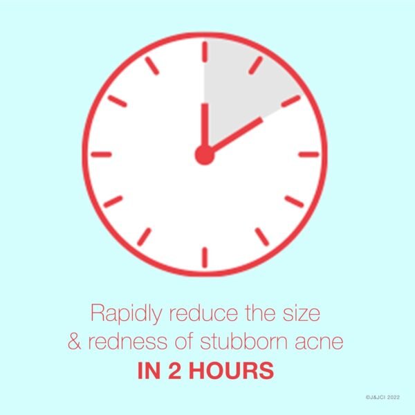 Neutrogena Rapid Clear Stubborn Acne Spot Treatment Gel, Maximum Strength 10% Benzoyl Peroxide Treatment Medication for Acne Prone Skin, Pimple Cream Reduces Size & Redness in 2 Hours, 1 oz