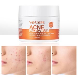 Acne Treatment for Face for Hormonal Cystic Stubborn Acne Cream for Sensitive Skin Teens Adults Women Men Spot Pimple Butt Control Rapid Clearing Breakout Overnight Face Blemish Treatment Moisturizer