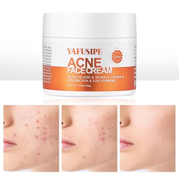 Acne Treatment for Face for Hormonal Cystic Stubborn Acne Cream for Sensitive Skin Teens Adults Women Men Spot Pimple Butt Control Rapid Clearing Breakout Overnight Face Blemish Treatment Moisturizer