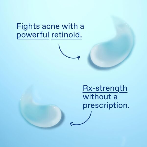 Differin Acne Treatment Gel, 30 Day Supply, Retinoid Treatment for Face with 0.1% Adapalene, Gentle Skin Care for Acne Prone Sensitive Skin, 15g Tube (Packaging May Vary)