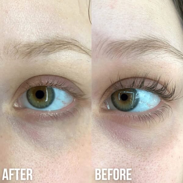 61g6Yn8nVWL._SL1024_.jpg Eyelash Serum - Lash Serum for Ticker, Longer and Fuller Lashes- Visible Results after 4 weeks - Restore Natural Grow and Reduces Hair Loss - Vegan and Cruelty-free Formula - Luxe Cosmetics