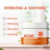 Acne Cream Pimple Cream for Face, Oil Control Pimple Remover Cream Get Rid of Pimples Fast,for Oily and Acne Prone Skin, Cruelty Free, Crema para espinillas en la cara