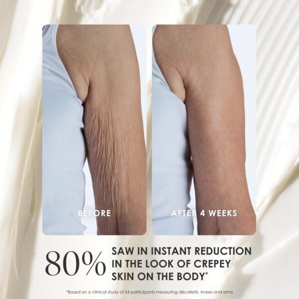 BODY FIRM Crepe Erase Advanced Body Repair Treatment, Anti-Aging Wrinkle Cream, Support Skins Natural Elastin & Collagen Production - 10oz