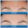 710Bu5Yik-L._SL1500_.jpg CeraVe Resurfacing Retinol Serum For Post Acne Marks, Formulated With Licorice Root Extract & Niacinamide, Brightening Serum & Pore Minimizer For Face, Post Acne Skin Barrier Repair, Non-Comedogenic