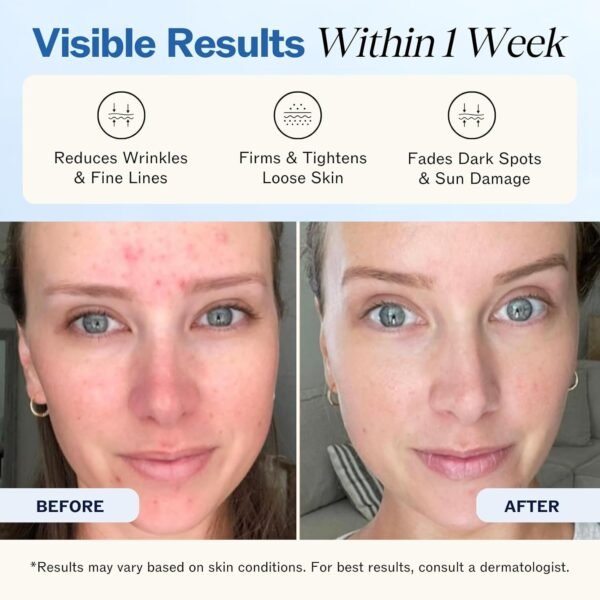 LilyAna Naturals Anti Aging Retinol Face Cream for Women – Wrinkle & Neck Cream for Firming, Retinol Moisturizer for Face with Hyaluronic Acid, Hydrating Night Cream for Fine Lines, Collagen Boost