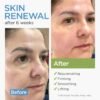 713kDZ31FcL._SL1500_.jpg Collagen Face Moisturizer with Stem Cells Retinol Hyaluronic Acid Niacinamide - Anti-Aging Collagen Face Cream with Airless Pump - Day & Night Moisturizer for Wrinkles - Made in USA