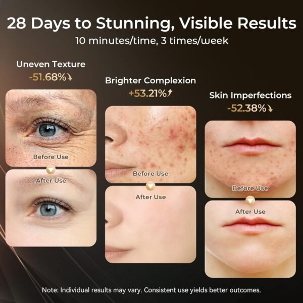 Red Light Therapy for Face-LED Face Mask Light Therapy with 3 Gears,2500mAh Battery,Remote Control,Infrared Red Light Therapy Mask for Home Working Travel Yoga Sleep