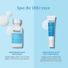 Murad Deep Relief Acne Treatment - Maximum Strength Acne Treatment with 2% Salicylic Acid and Phytosteroid for Deep, Painful Acne Breakouts and Redness - Accelerated Healing Treatment - 1 Fl Oz