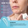 71IJc2kOtuL._SL1500_.jpg Enaskin Naturals Acne Pimple Spot Treatment Cream: Cystic Hormonal Blackheads Blemish Remover for Face, Back and Body - with 10% Azelaic Acid - Teens 13-19 & Young Adult 20-30, 1.8 oz