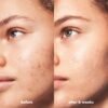 71MoM6533L._SL1500_.jpg e.l.f. SKIN Blemish Breakthrough Calming Water Cream, Lightweight Blemish-Fighting Face Moisturiser, Prevents New Blemishes & Calms Skin