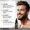 Minoxidil for Men Beard Growth Kit, Minoxidil for Women Hair Growth Kit, Hair Loss Treatments for Women Hair Regrowth Treatment, Minoxidil 5%, Black