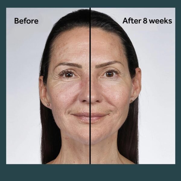 No7 Future Renew Damage Reversal Night Cream - Anti Aging Face Moisturizer for Women - Infused with Peptide Technology to Reverse Visible Signs of Damage - Skin Barrier Repair for Dry Skin (1.69 Oz)