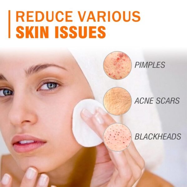 Acne Cream, Acne Spot Cream for Face and Body, Pimple Cream Spot, Reduce Cystic AcNe for Face, Back & Butt AcnE Clearing CreaM for Teens & Adults