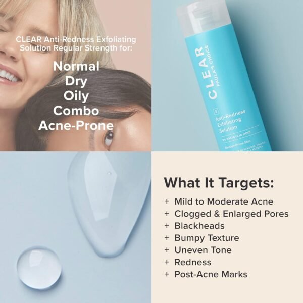 71UF7pnoZoL._SL1500_.jpg Paula's Choice CLEAR Anti-Redness Exfoliating Solution, 2% Salicylic Acid Exfoliant, for Mild to Severe Acne & Breakouts, Blackheads and Clogged Pores, Fragrance-Free, 4 Fl. Oz