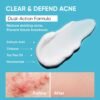 Butt Acne Clearing Treatment Cream: Clears & Prevents Breakouts Fast – Gentle Body & Back Lotion for Clogged Pores, Folliculitis & Bumps, 2% Salicylic Acid & Niacinamide, Ideal for Women, Men & Teens