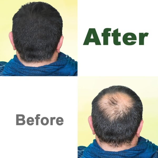 GoldWorld100% Organic Pure Black Castor Oil Cold Pressed,for Hair Eyebrows Eyelash Growth Serum to Grow Lashes,Castor Oil for Skin Body Face,Caster Oils Unrefined in Glass Bottle Hexane Free