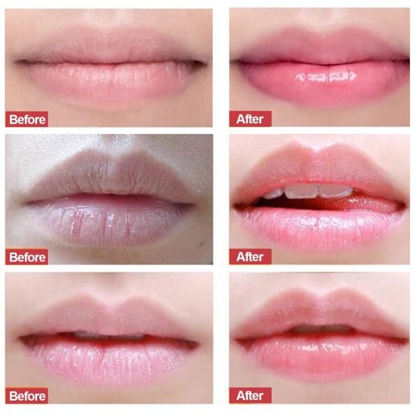 71f7TX7prL._SL1500_.jpg Strawberry Lip Scrub & Repair, Exfoliator & Moisturizer for Chapped, Dry and Flaky Lips