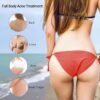 71fKpN84pKL._SL1500_.jpg Butt Acne Clearing Treatment, Maximum Strength Body Cream for Back, Buttocks, Thigh & Chest Acne Removal, Skin Clearing Lotion for Men & Women, Foaming Cleanser for Bacne & Cystic Acne