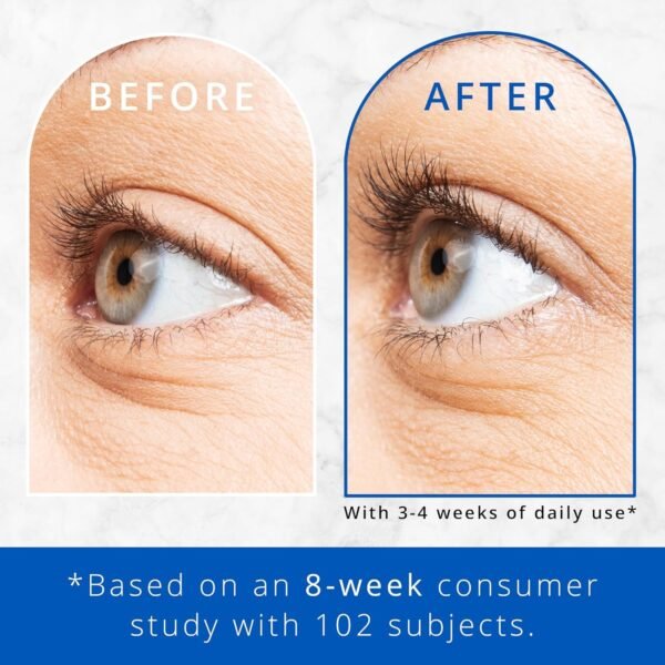 71gePNezfdL._SL1500_.jpg Eye Lash Enhancing Serum for Thicker, Longer Looking Lashes - neuLASH Eyelash Serum by Skin Research Laboratories - Advanced Formula Improves the Look of Natural Lash Follicles & Healthy Lash Lines
