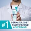 71hgX7q8qoL._SL1500_.jpg CeraVe Acne Foaming Cream Cleanser, 4% Benzoyl Peroxide Face Wash With Hyaluronic Acid, Niacinamide & Ceramides, Gentle Daily Acne Treatment For Face