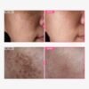 71m64lZxnOL._SL1500_.jpg Arbutin 7% + Tranexamic Acid 4% Cream, 70,000ppm Arbutin, 40,000ppm TXA, Niacinamide, Glutathione, Dark Spots, Freckle, Blemishes, Pigmentation, Korean Skin Care, 50ml, 1.69 fl.oz.