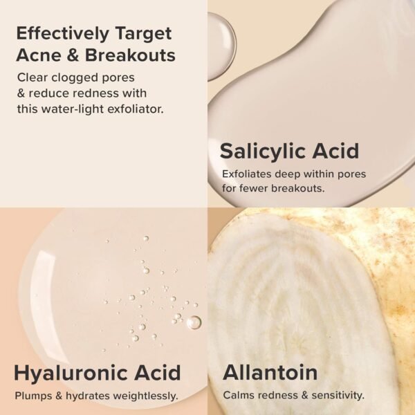 71mLZFeM1kL._SL1500_.jpg Paula's Choice CLEAR Anti-Redness Exfoliating Solution, 2% Salicylic Acid Exfoliant, for Mild to Severe Acne & Breakouts, Blackheads and Clogged Pores, Fragrance-Free, 4 Fl. Oz