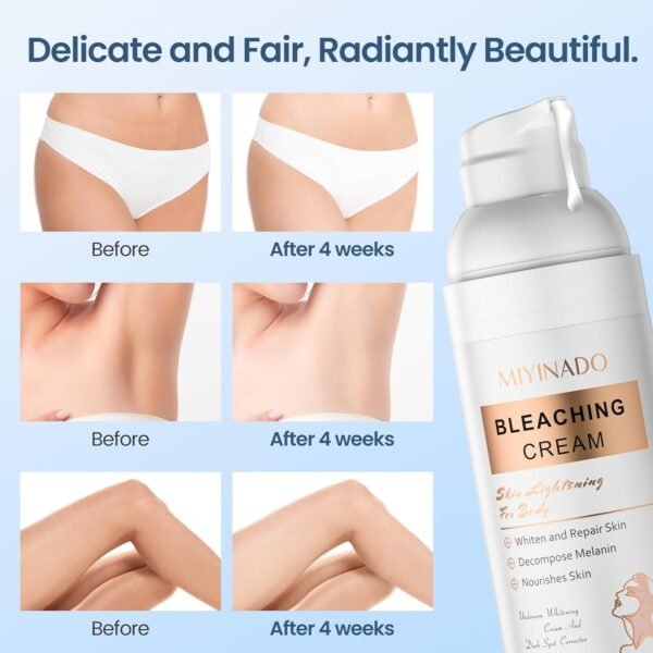 71oUEghu54L._SL1500_.jpg Skin Lightening Cream - Vitamin C Dark Spot Remover for Underarms, Knees, Elbows & Bikini Line/whitening cream/skin bleach (50ml/1.69FL.OZ)