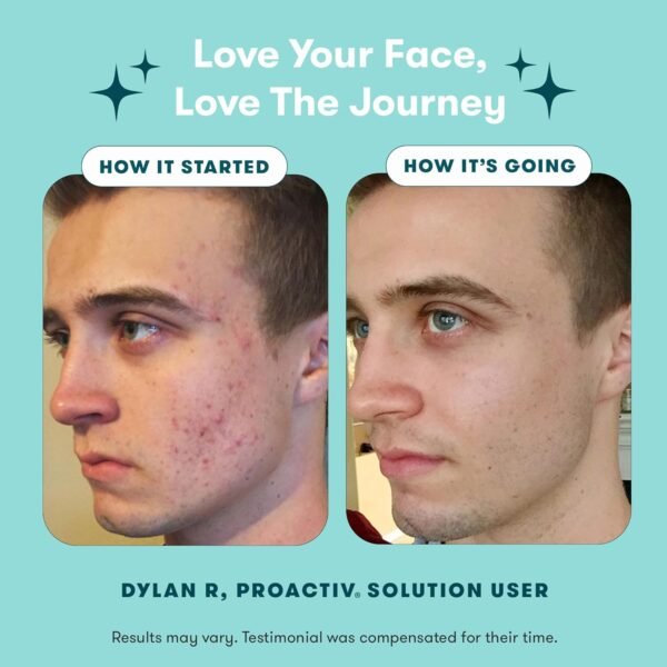 71pSztMx73L._SL1500_.jpg Proactiv 3 Step Acne Treatment - Benzoyl Peroxide Face Wash, Repairing Acne Spot Treatment for Face and Body, Exfoliating Toner - 30 Day Complete Acne Skin Care Kit