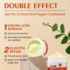 Acne Cream Pimple Cream for Face, Oil Control Pimple Remover Cream Get Rid of Pimples Fast,for Oily and Acne Prone Skin, Cruelty Free, Crema para espinillas en la cara
