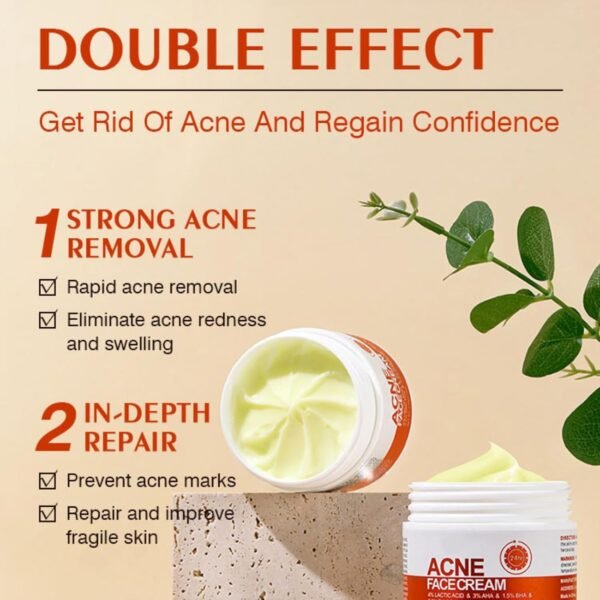 Acne Cream Pimple Cream for Face, Oil Control Pimple Remover Cream Get Rid of Pimples Fast,for Oily and Acne Prone Skin, Cruelty Free, Crema para espinillas en la cara