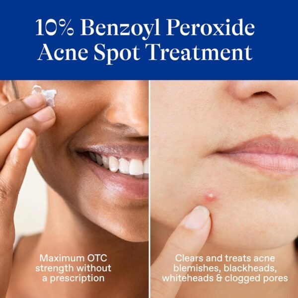 71t5uePiDwL._SL1500_.jpg Differin Acne Spot Treatment with 10% Benzoyl Peroxide, Maximum Strength OTC Acne Treatment, Fast Acting Spot Treatment for Face, 1 oz