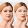 71vGIWSkrbL._SL1500_.jpg EnaSkin Anti Aging Face Cream: Retinol Collagen Wrinkle Moisturizer for Women - 7% Hyaluronic Acid - Day/Night Facial Sagging Skin Care & Firming Neck, 1.7 fl oz