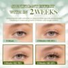 71ycmZT5a8L._SL1500_.jpg Eyelash Serum, Lash Serums for Thicker, Longer and Fuller Eyelashes, Eyelash Growth Serum