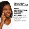 81-g2jWHrDL._SL1500_.jpg La Roche-Posay Effaclar Adapalene Gel 0.1% Acne Treatment, Retinoid Cream, Acne Medication Gel For Blackheads & Whiteheads, Oil Free, Helps Clear And Prevent Blemishes & Clogged Pores