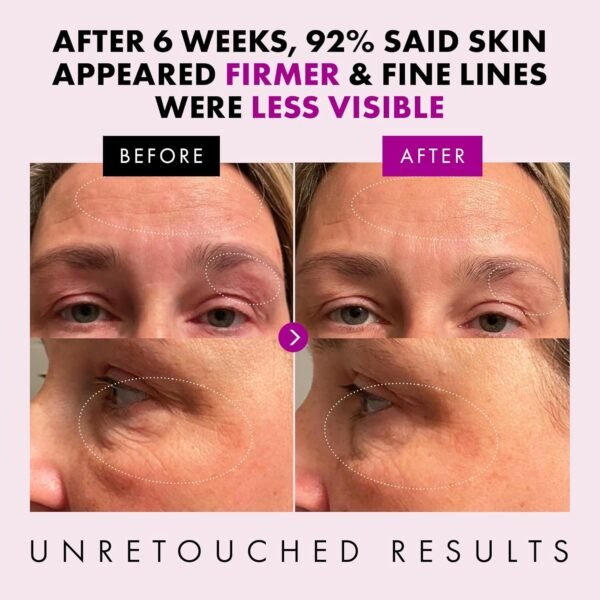 Eclat Skincare Anti Aging Face Cream - Hydrating Face Moisturizer with Collagen Peptides, Hyaluronic Acid, & Vitamins C+E - Improves Fine Lines and Wrinkles - Daily Facial Moisturizer 50 ml