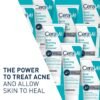 815Tlv3jFDL._SL1500_.jpg CeraVe Acne Foaming Cream Cleanser, 4% Benzoyl Peroxide Face Wash With Hyaluronic Acid, Niacinamide & Ceramides, Gentle Daily Acne Treatment For Face