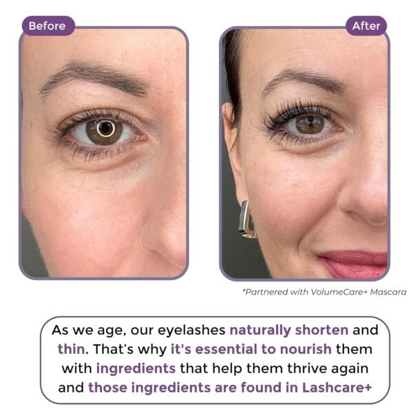 LashCare+ Eyelash Enhancing Serum For Older Women - Longer, Thicker Lashes in 12 Weeks - For Sensitive Eyes, Natural Growth - Enhancement, Conditioner for Longer-Looking Lashes (1mL (1 Month Supply))