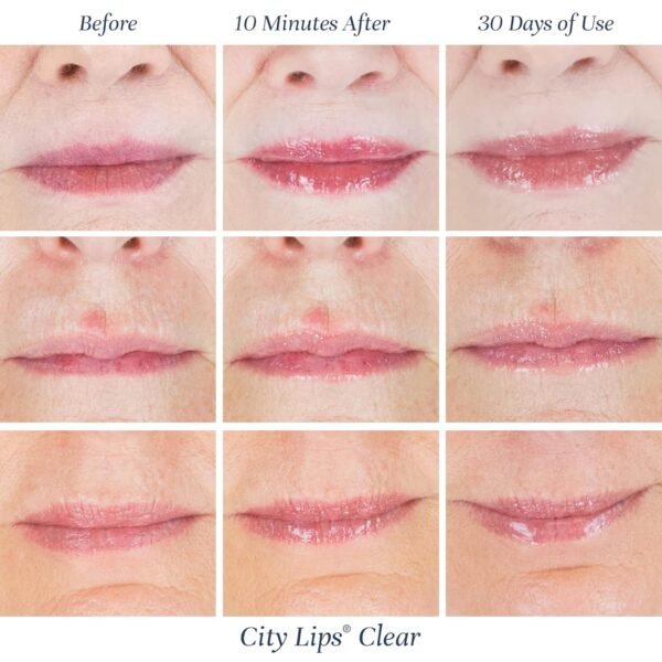 8182iUXbLHL._SL1500_.jpg City Beauty City Lips Clear - Plumping Lip Gloss - Hydrate & Volumize - High Shine Lip Plumper - Hyaluronic Acid & Peptides Visibly Smooth Lip Wrinkles - Cruelty-Free