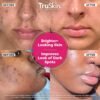 8188TMoH5L._SL1500_.jpg TruSkin Vitamin C Super Serum - Niacinamide, Retinol, Hyaluronic & Salicylic Acid - All-in-One Anti Aging Serum for Face – Improve Appearance of Dark Spots, Firmness for Brighter Looking Skin, 2 Fl Oz