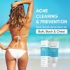 Butt Acne Clearing Treatment Cream: Clears & Prevents Breakouts Fast – Gentle Body & Back Lotion for Clogged Pores, Folliculitis & Bumps, 2% Salicylic Acid & Niacinamide, Ideal for Women, Men & Teens