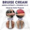 81KNfgC4sjL._SL1500_.jpg SKINTENSIVE Arnica Bruise Cream for Thin Skin - Moisturizing, Vitamin K C and E, Skin Renewal, 4 Oz