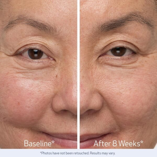 Obagi Nu-Cil Eyelash Enhancing Serum & Eyebrow Boosting Serum Set – Clinically Proven Formulas for Thicker & More Defined Looking Lashes & Fuller Looking Eyebrows