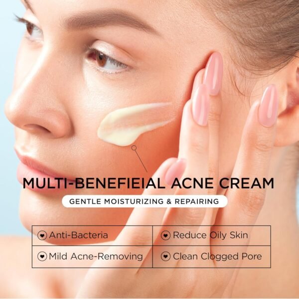 Acne Treatment for Face: Cystic Acne Spot Control Cream with Salicylic Acid & Tea Tree Oil for Blemishes - Gentle Hormonal & Pimple Treatment for Teens & Adults - 120 Day Supply & 3.38oz